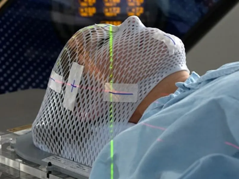 رادیوسرجری چیست؟