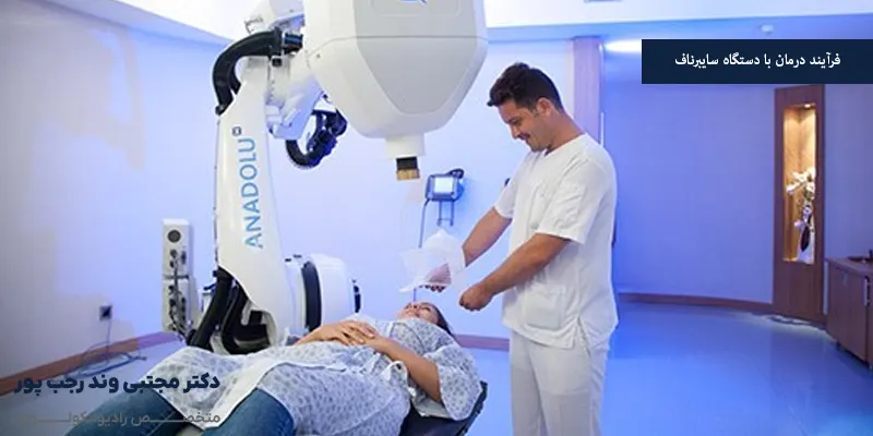 فرآیند درمان با دستگاه سایبرناف