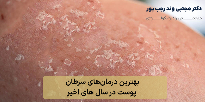 بهترین درمانهای سرطان پوست در سال های اخیر