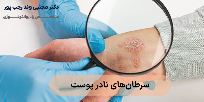 سرطانهای نادر پوست