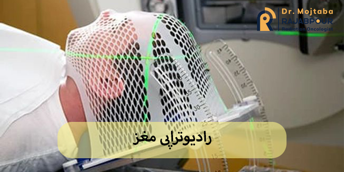 رادیوتراپی مغز