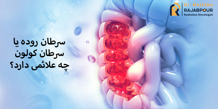 سرطان روده یا کولون
