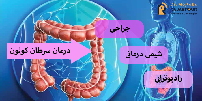 درمان سرطان کولون